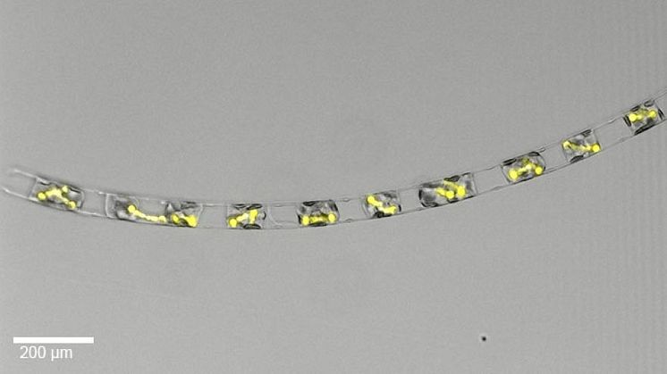 Mikroskopbild av cellkedja där varje cell innehåller kluster av lysande gula strukurer. 