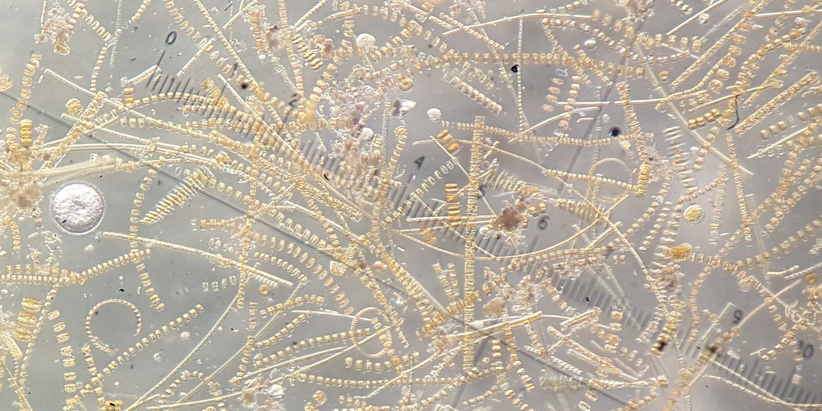 Diatoms sampled during the spring bloom in the Barents Sea. Marine microalgae bind CO2 through photosynthesis, producing organic carbon and oxygen. Photo: Eva Leu/Akvaplan-niva
